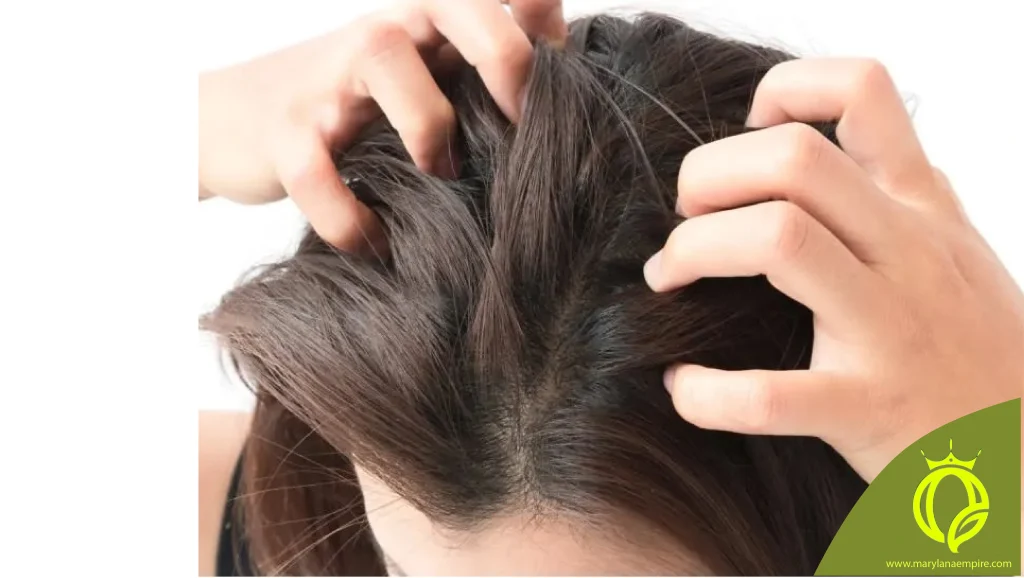 رفع خارش سر/ درمان خارش سر