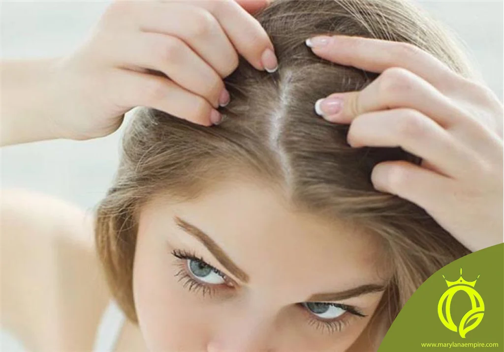 درمان چربی کف سر / رفع چربی سر